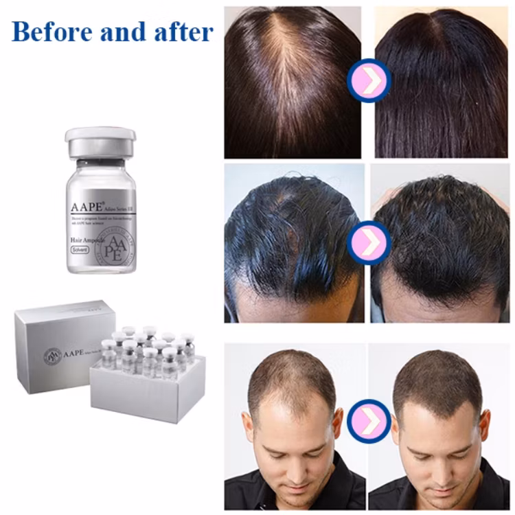 Aape Anti-Hair Loss Hair Loss Care Repair Hair Growth Hair Regeneration Stem Cell Therapy