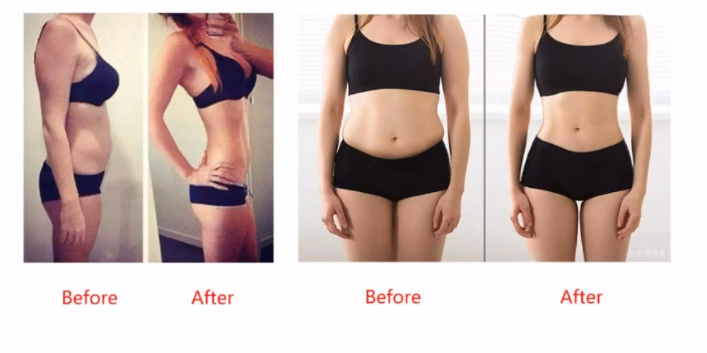 Korean Lipo-Dissolving Product Lipo Lab 10ml*10 Bottles Dissolves Excess Fat, Dermal Injection Creates a Perfect Body, Lipolysis