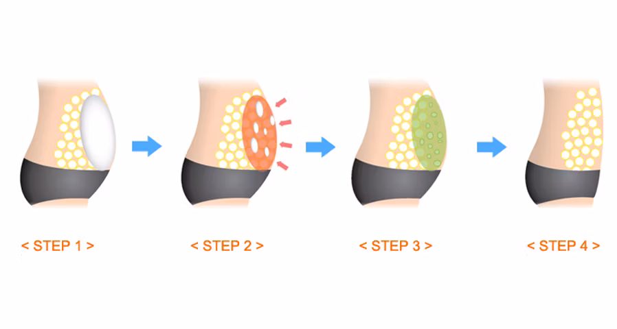 2023 Korea Top Quality FDA Certification Fat Dissolving Solution Weight Loss Anti Stretch Mark Body Slimming Mesotherapy Solution Lipolysis Injection