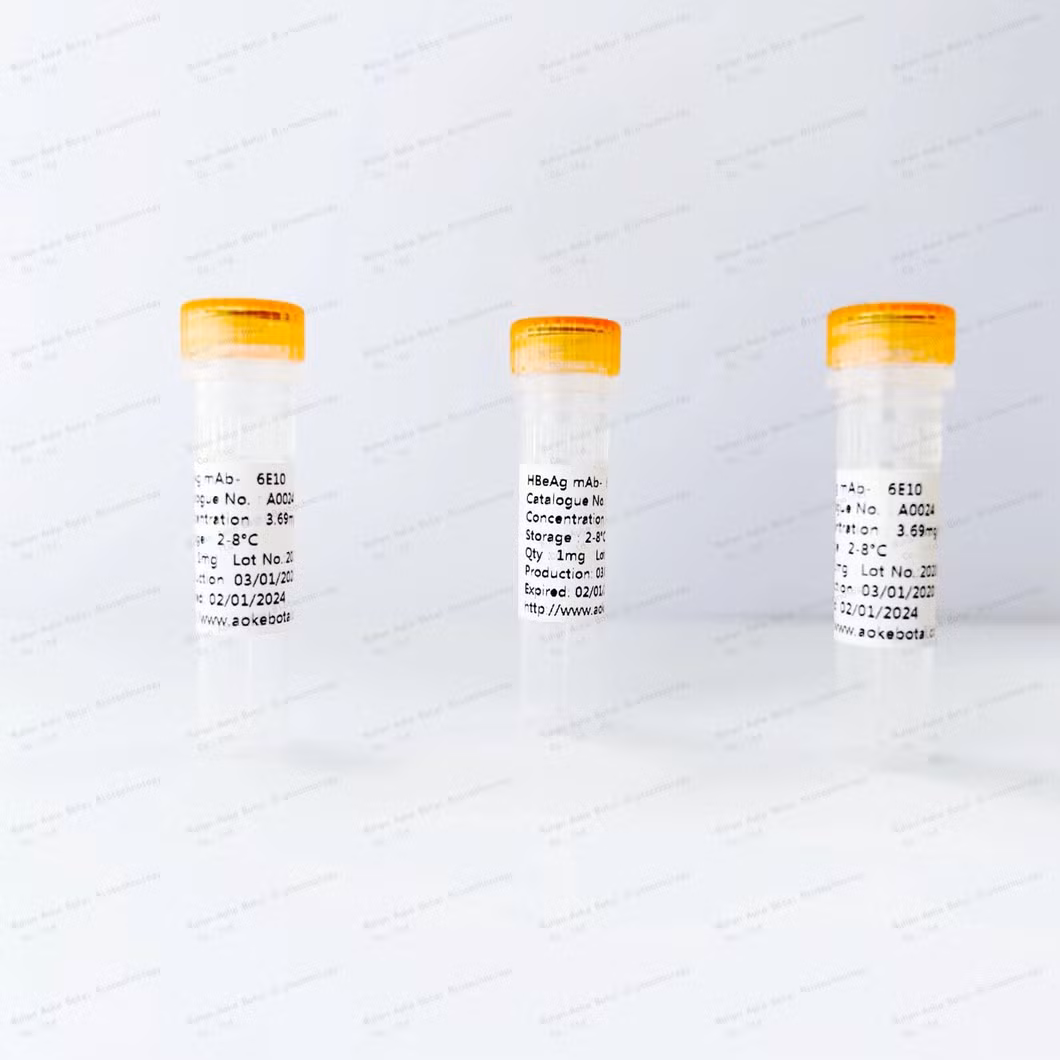 High quality Pappa-A antibody pairs for your elisa test kits from Auker Biotech