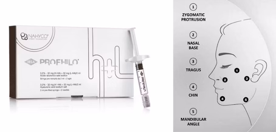 Korea Save B32 Save B32sp Profhilo Hyaluronic Acid Dermal Filler for Face Neck Lift Whitening and Anti-Aging