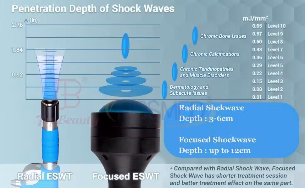 Extracorporeal Shock Wave Therapy Focused Shockwave Eswt Pain Physiotherapy Relief Machine