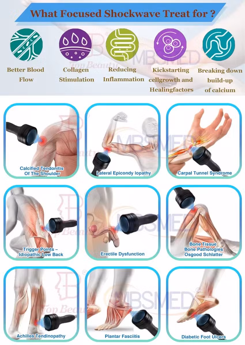 Extracorporeal Shock Wave Therapy Focused Shockwave Eswt Pain Physiotherapy Relief Machine