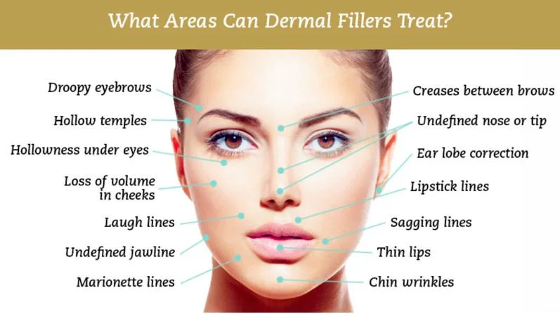 Hyalyronic Acid Injection Lips Dermal Filler Used by Hyaluron Pen