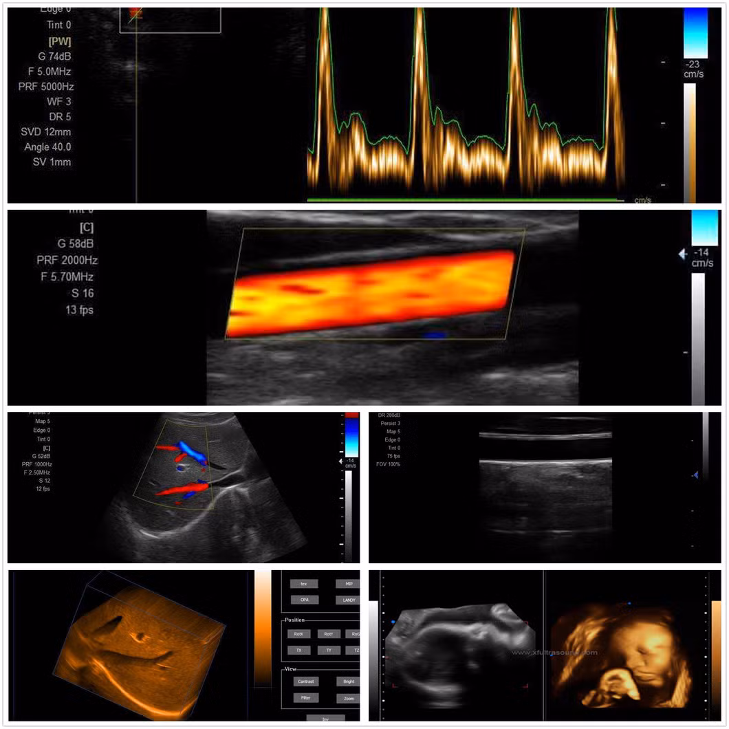 Hospital Medical Cart / Trolley Color Doppler 2D 3D 4D Ultrasound Scanner Machine