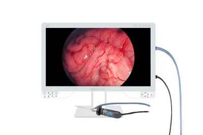 Endoscopio medico endoscopia LED freddo sorgente di luce 100 Watt con Cavo in fibra ottica