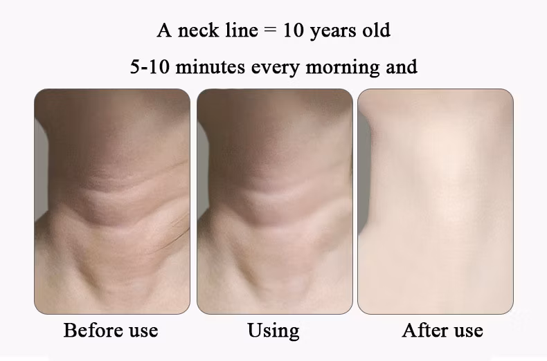Neck Care Instrument to Remove Neck Lines and Nasolabial Lines Import Instrument to Lift Facial Color Light Beauty Neck Instrument