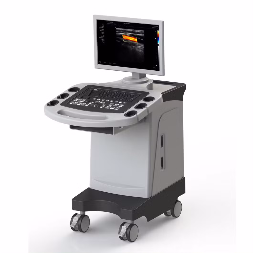 Rayman Color Doppler Ultrasonic Machine 2D 3D Function Trolley Ultrasound Scanner