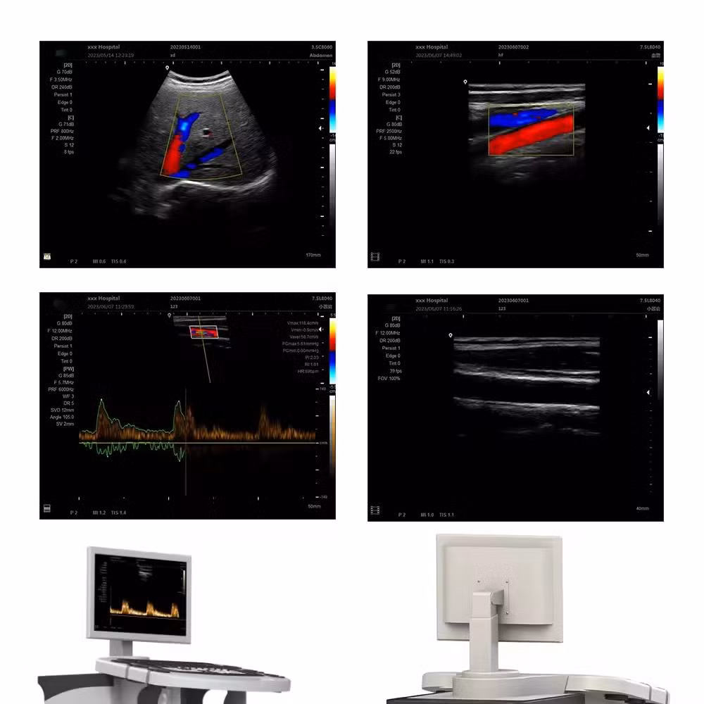 Rayman Color Doppler Ultrasonic Machine 2D 3D Function Trolley Ultrasound Scanner