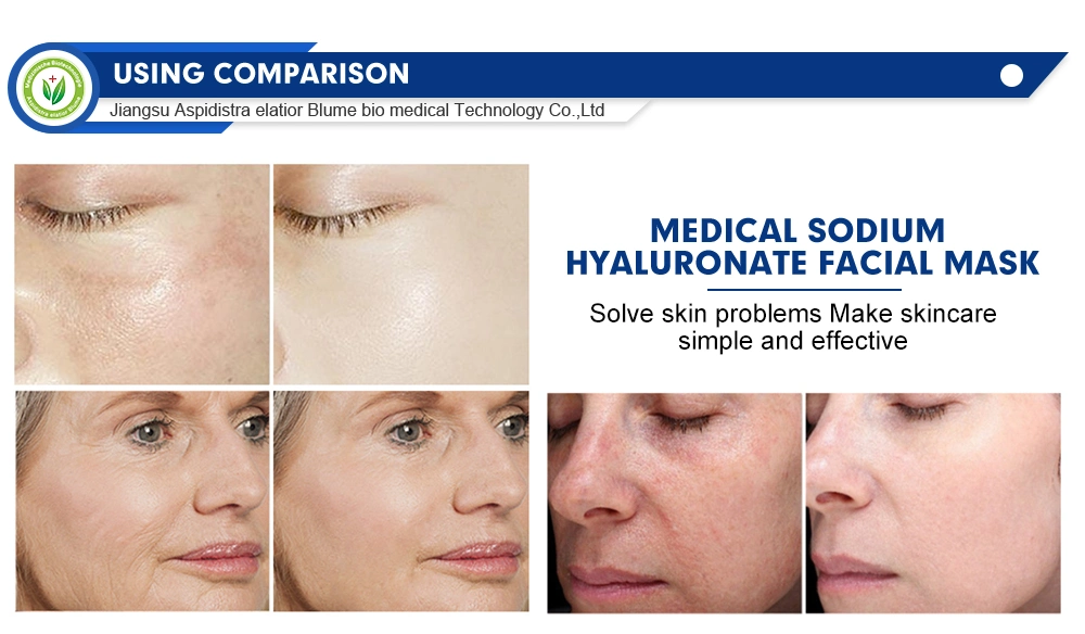 Skin Care Sunburn Repairing Rescue Damaged Skin Medical Cold Compress Repair After Sunburn Hyaluronic Acid Gel Facial Mask