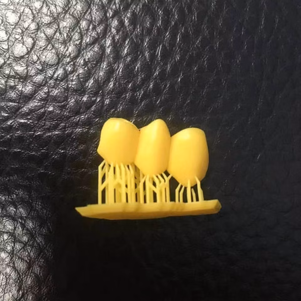 3D UV-Curing Dental Medical Care Resin 405nm Dental Model Resin with Lower Shrinkage &amp; High Precision 3D Slp/LCD Printers Easy-Print Dental Resin 1000g