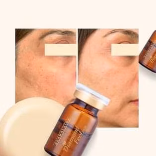 Dimand Feel Forte Dermal Sign Skin Booster Anti Wrinkles Anti-Aging and Whitening Wrinkle Removing Skin Elasticity Ampoule Skin Booster