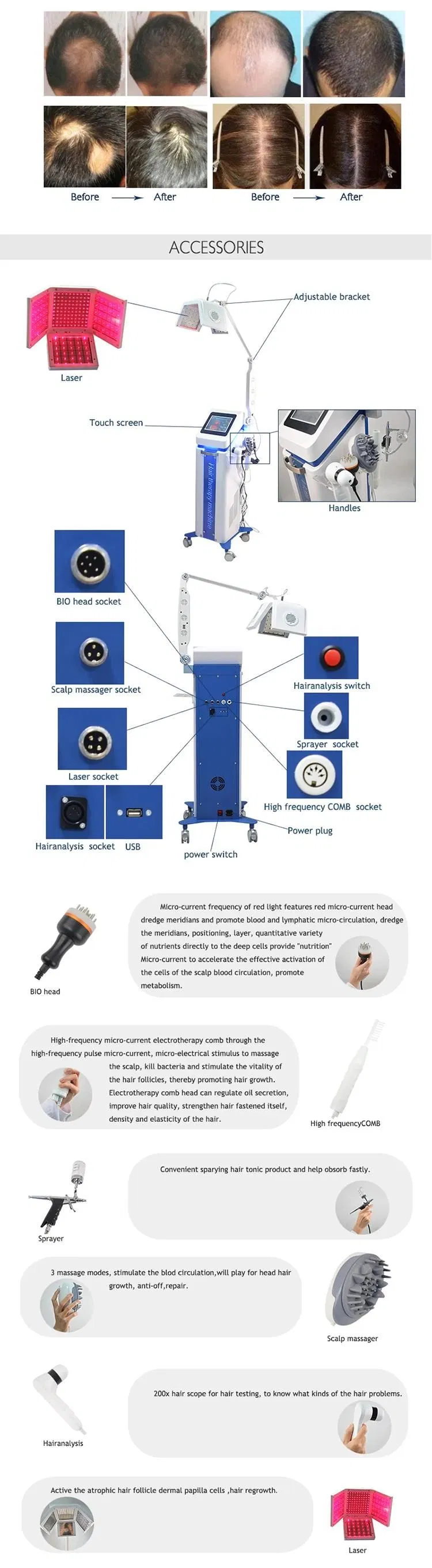 Hair Light Diode Laser Hair Loss Treatment Growth 650nm Machine No LED Machines Beauty Salon Equipment Laser Hair Regrowth