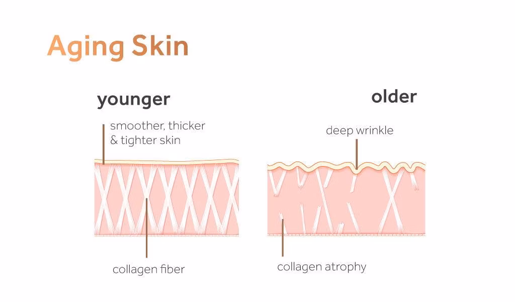 Medical Beauty Otesaly Collagen Lift Serum 25ml Pdrn Skin Therapy Stem Cell Moisturizes Plumps The Skin Shrinks Pores