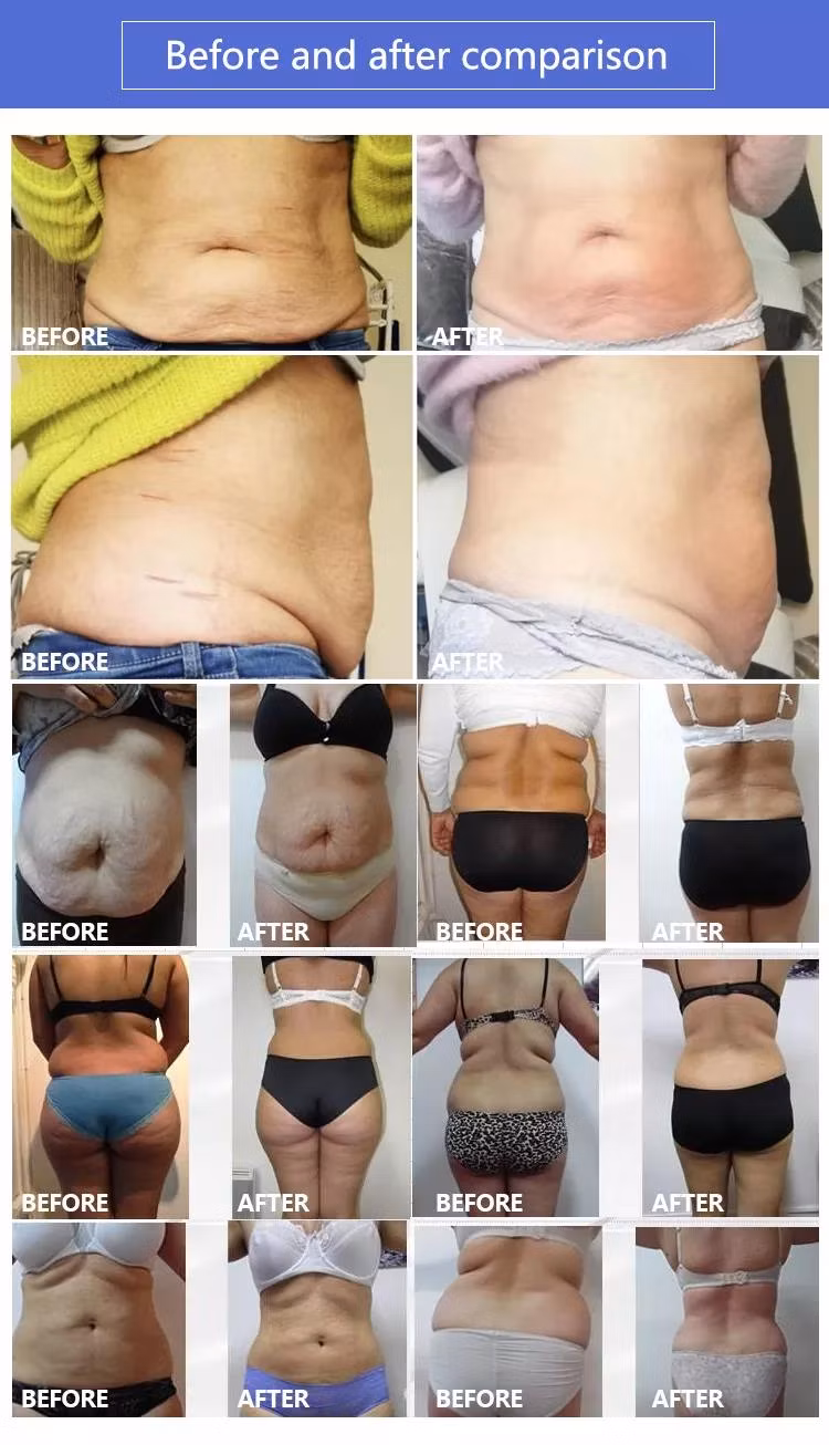 24 Bags Air Pressure Lymphatic Dredging Professional Pressotherapy 3 in 1 Pressotherapy Machine Cellulite Reduction Pressotherapy Machine