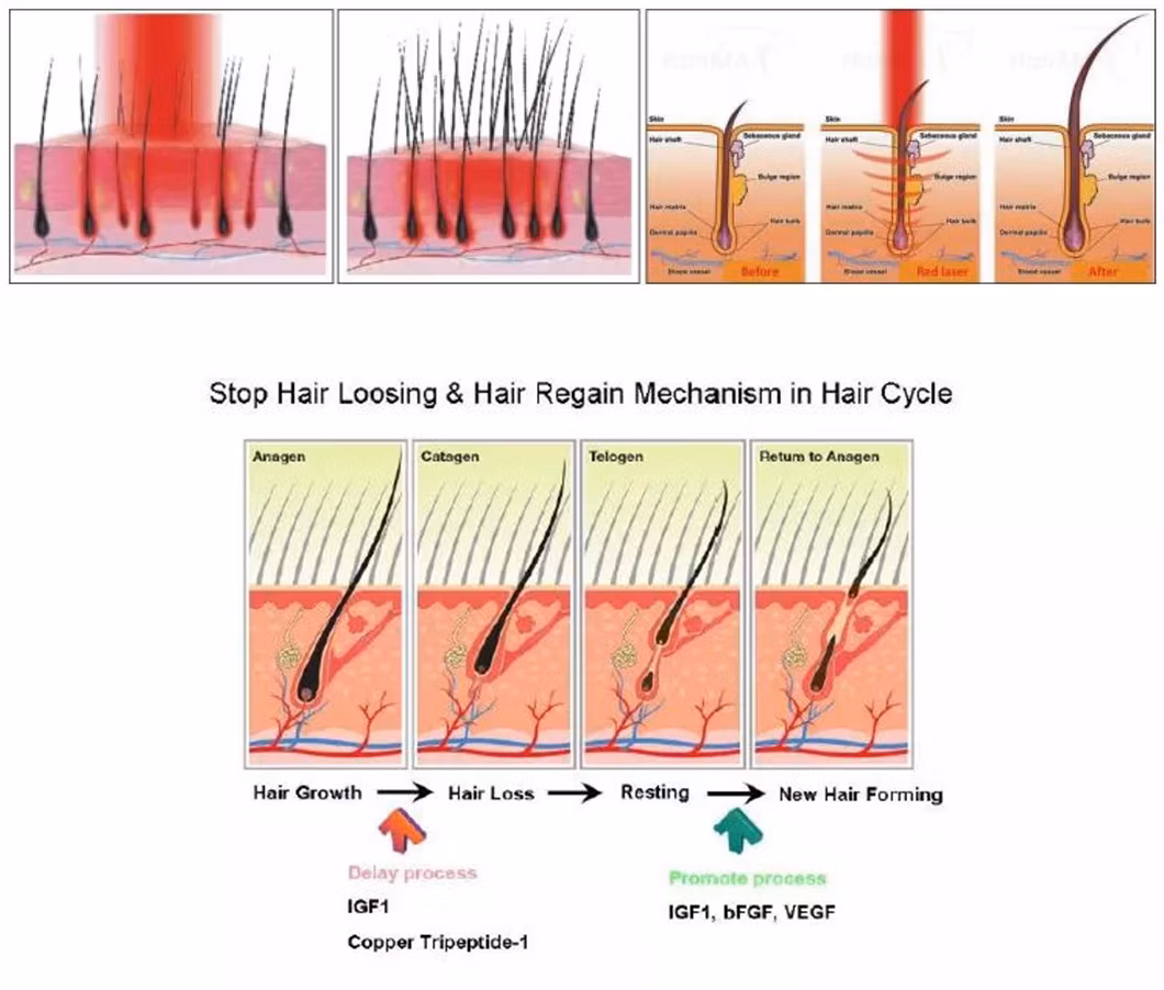 Stimulation of Epidermal Stem Cells The Hair Follicle Laser Hair Growth Massager