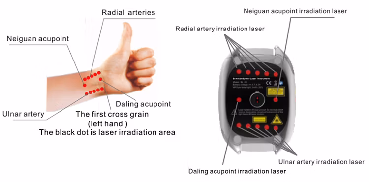 Laser Acupuncture Treatment Therapeutic Health Therapy Wrist Smart Watch