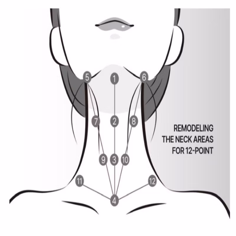 Korea Save B32 Save B32sp Profhilo Hyaluronic Acid Dermal Filler for Face Neck Lift Whitening and Anti-Aging