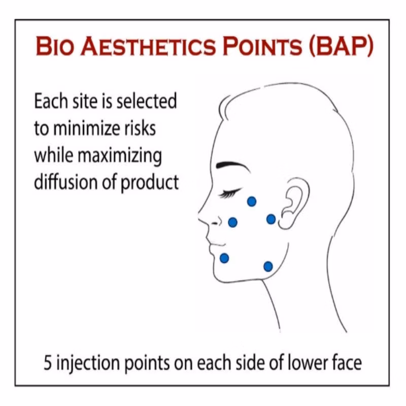 Korea Save B32 Save B32sp Profhilo Hyaluronic Acid Dermal Filler for Face Neck Lift Whitening and Anti-Aging
