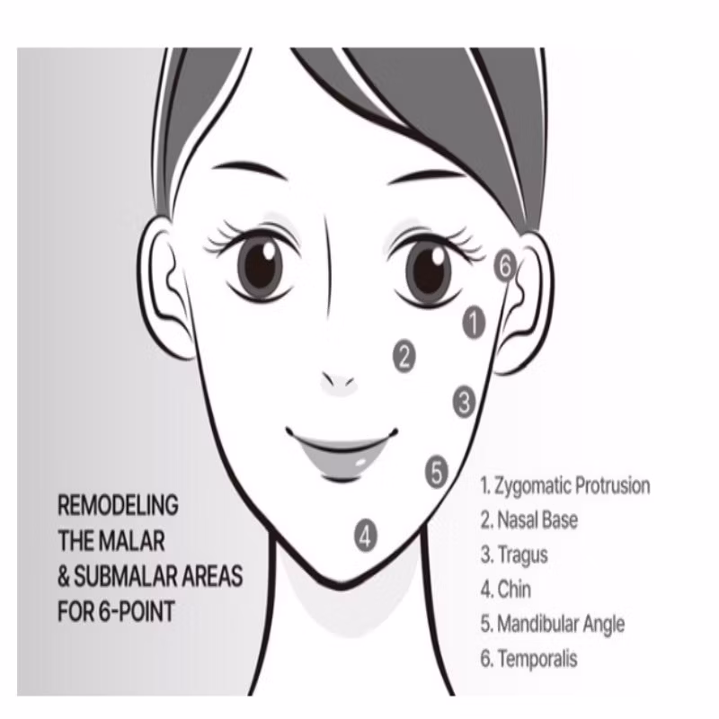 Korea Save B32 Save B32sp Profhilo Hyaluronic Acid Dermal Filler for Face Neck Lift Whitening and Anti-Aging