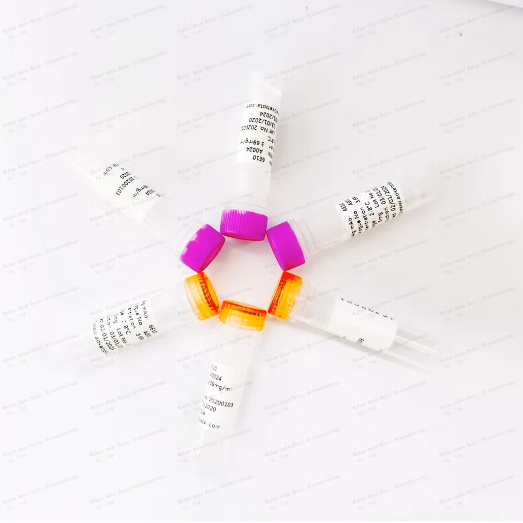 High quality Pappa-A antibody pairs for your elisa test kits from Auker Biotech