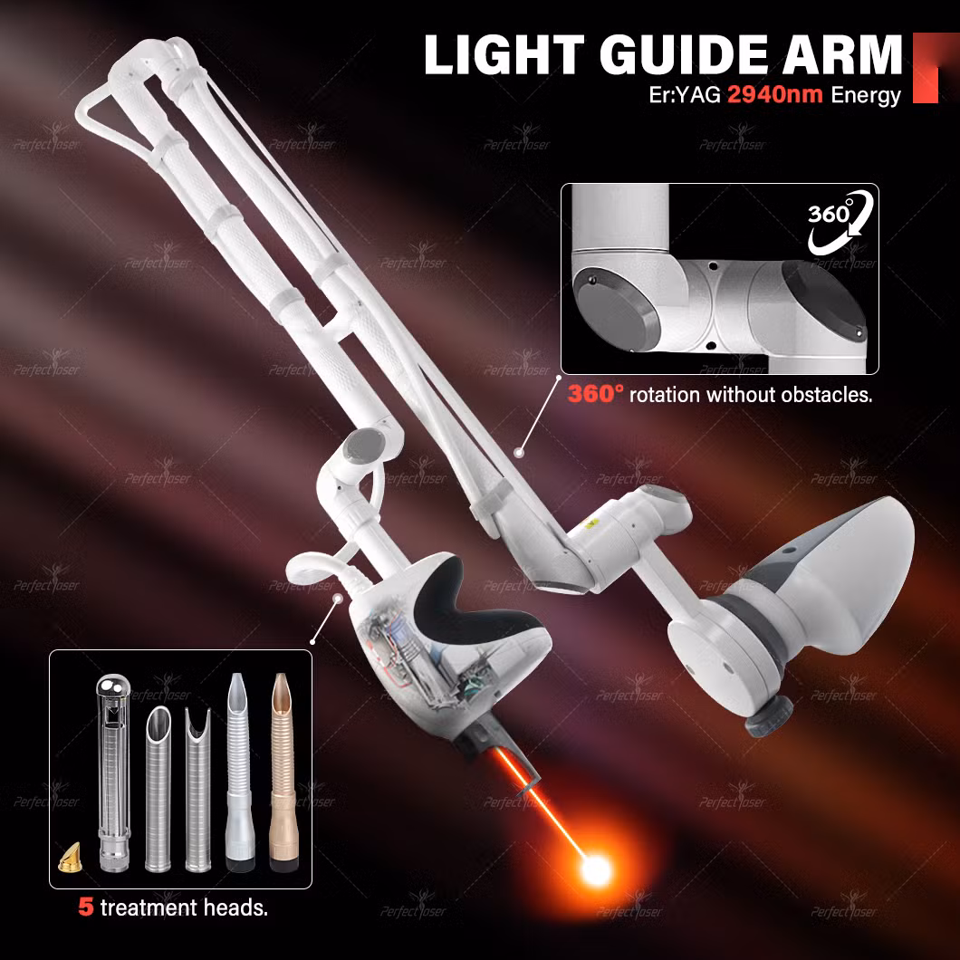 Professional Acne Removal Smoothliftin 4D Fotona Laser Red Light Spectrum 1064nm Instrument