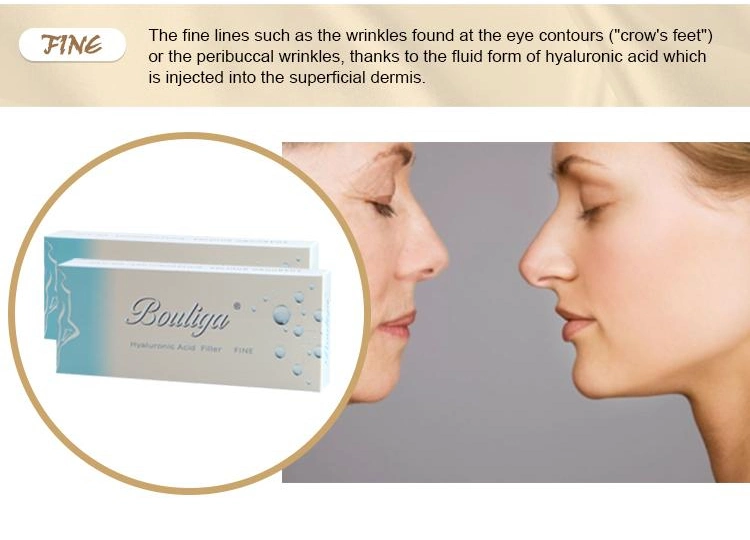 Disposable Cross Linked Injectable Hyaluronic Acid Filler for Face and Body