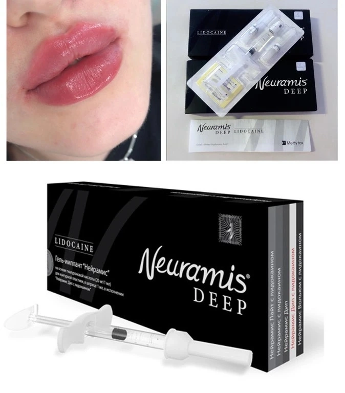 Yvoire Hyaldew Metoo Neuramis Eptq Derm Line Lip Augmentation Long Lasting Injectable Hyaluronic Acid Dermal Filler Lip Full Korea CE for Hyaluron Pen