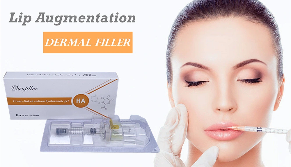 Disposable Medical Supplies Hyaluronic Acid Injection Skin Care Lip Augmentation Fillers for Plastic Surgery Implant