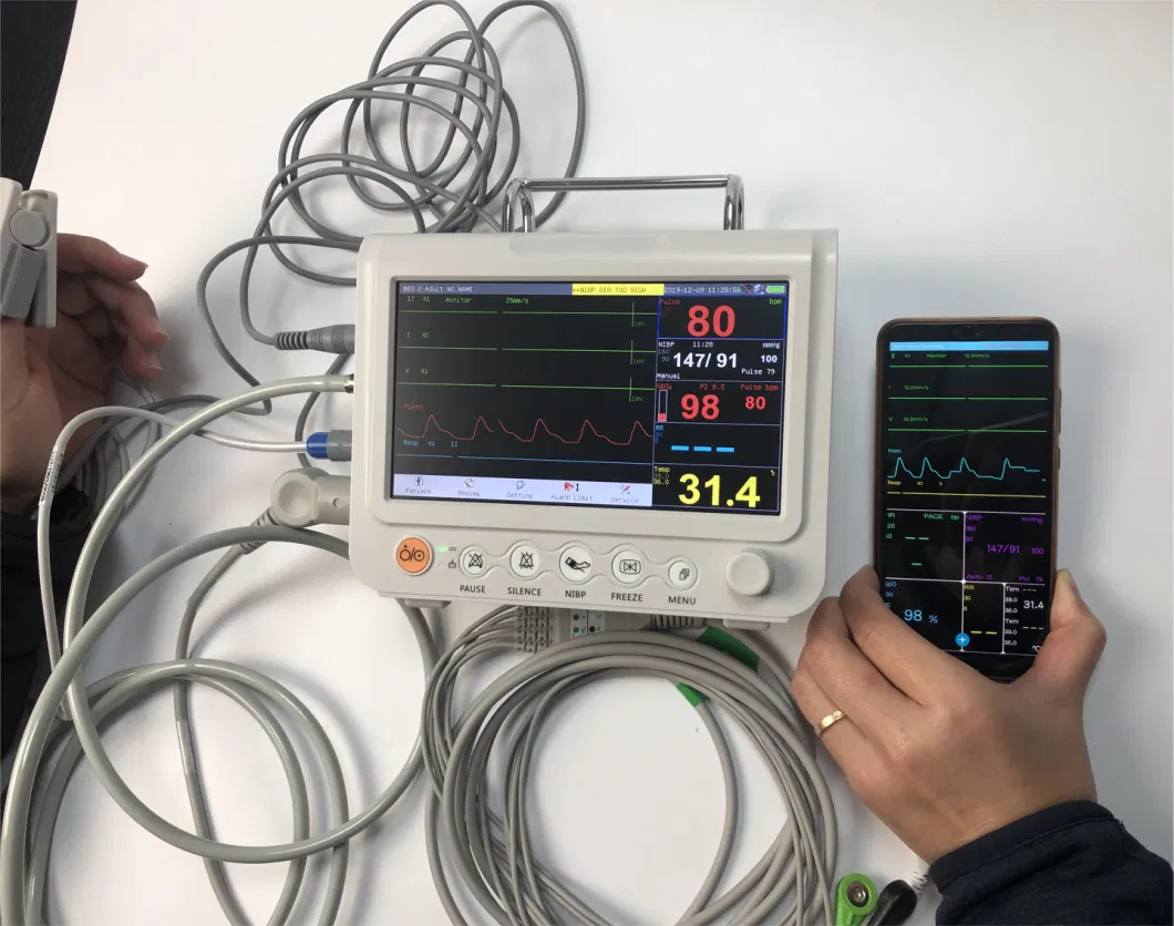 7 Inch Vet Patient Monitor