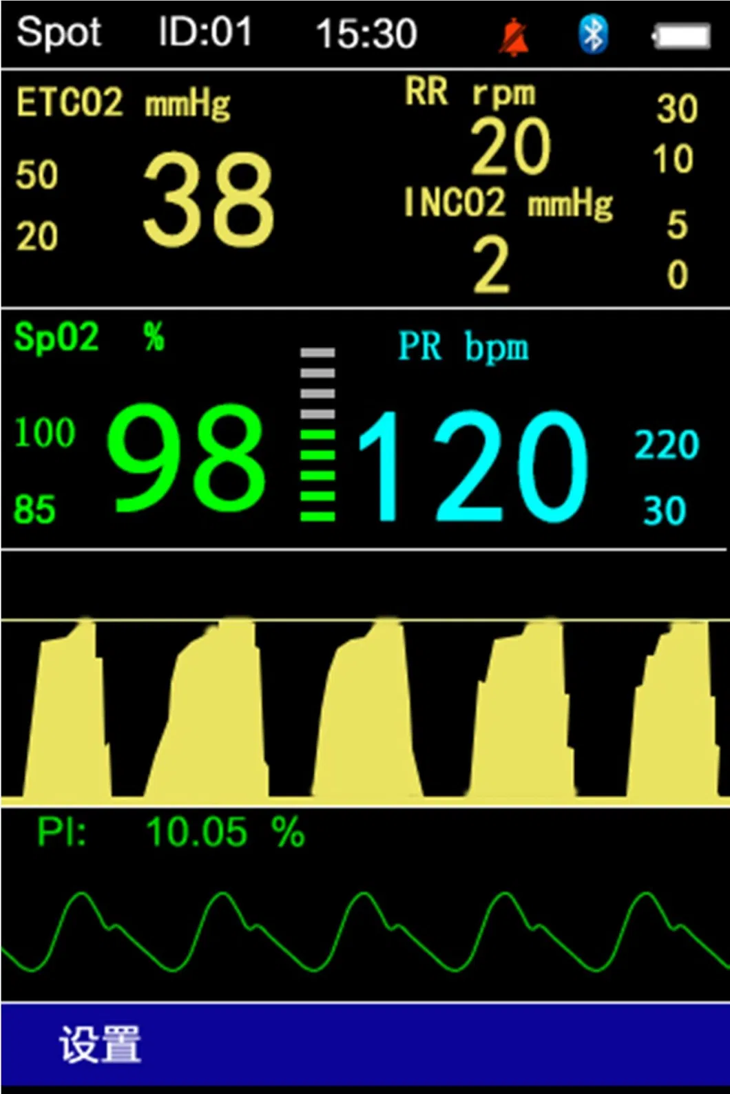 Portable Tabletop Digital OEM/ODM ICU Vital Sign Monitor for SpO2 + CO2