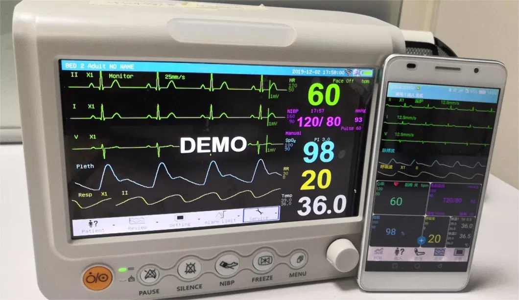 7 Inch Vet Patient Monitor