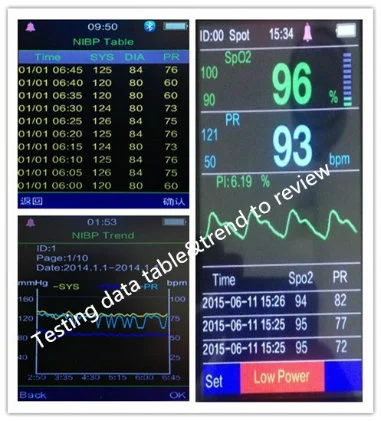 Portable Tabletop Digital OEM/ODM ICU Vital Sign Monitor for SpO2 + CO2