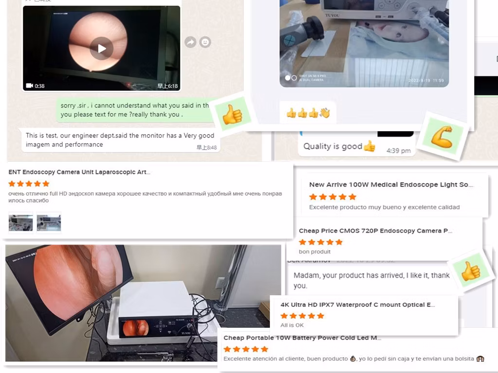 Ent Examination Laparoscope Camera Medical Endoscopy Equipment with High Resolution