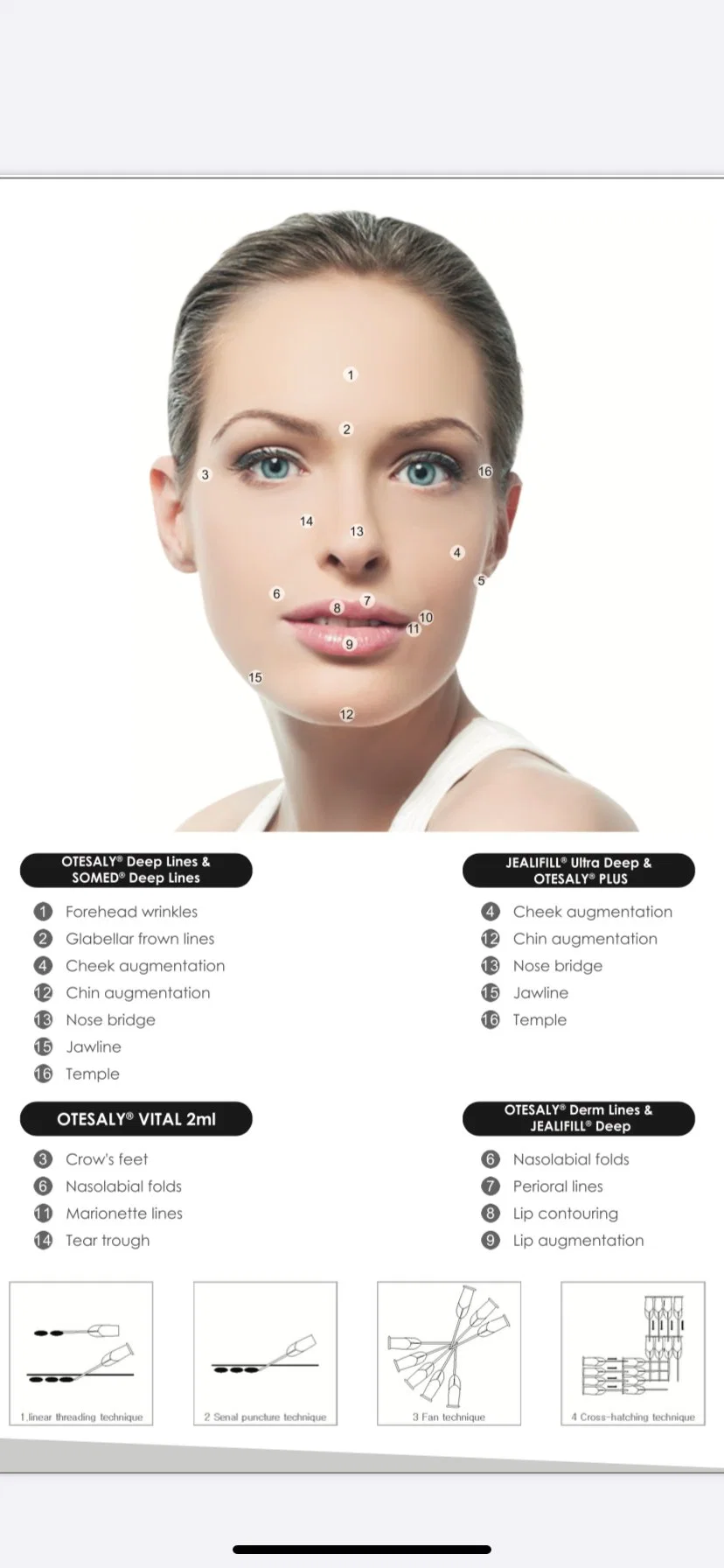 CE Certified Otesaly Injectable Cross Linked Cheek Lip Hyaluronic Acid Filler Non-Animal Dermal Filler Injections