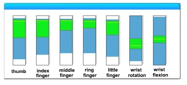 Hand Therapy Rehabilitation Equipment Manufacturer Sheepskin Rehabilitation Gloves