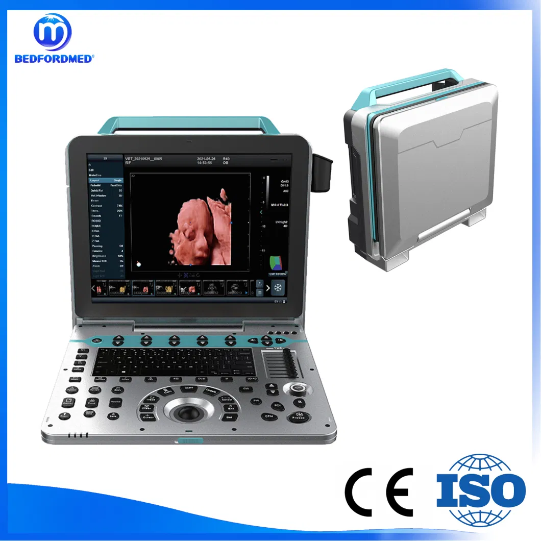 Hospital Medical Ultrasonic Diagnostic System with LCD Medical Monitor Me-P50 V3.0s