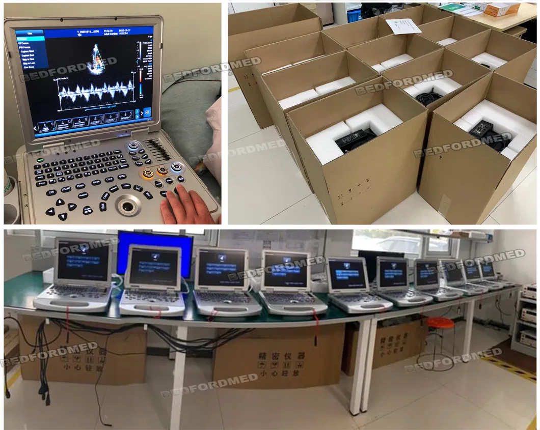 Hospital Medical Ultrasonic Diagnostic System with LCD Medical Monitor Me-P50 V3.0s