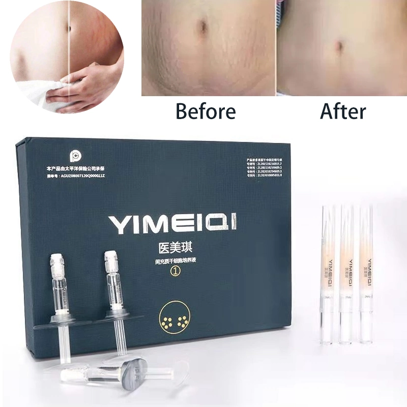 Korean Yimeiqi Gestational Stria Cell Culture Solution Sleeve Box Desalination of Acne Marks and Pits Obese Stria Electric Micro Needle Household