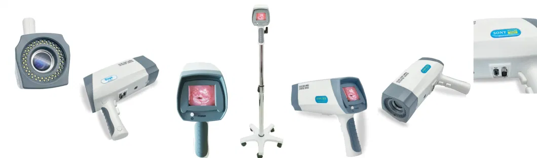 Best Price HD Video Colposcopy Medical Vagina Examination Video Colposcope for Woman Use