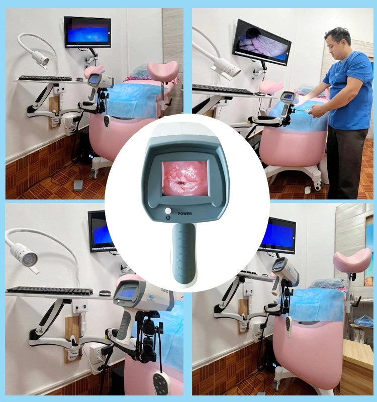 Hospital Use Medical Video Colposcope Digital for Cervix Vagina Examination