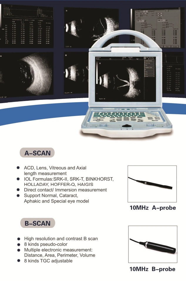 China Full Digital Ophthalmic a/B Ophthalmic Optical Ultrasound Scanner