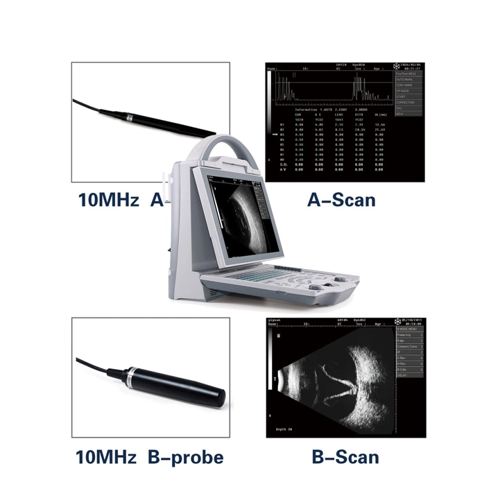 China Full Digital Ophthalmic a/B Ophthalmic Optical Ultrasound Scanner