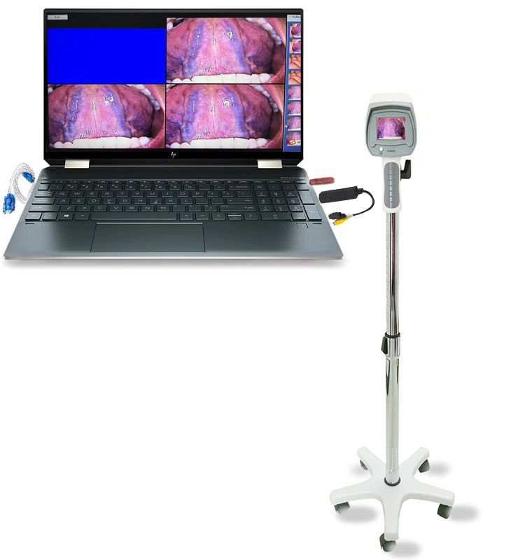 Digital Hospital Use Laptop Colposcope