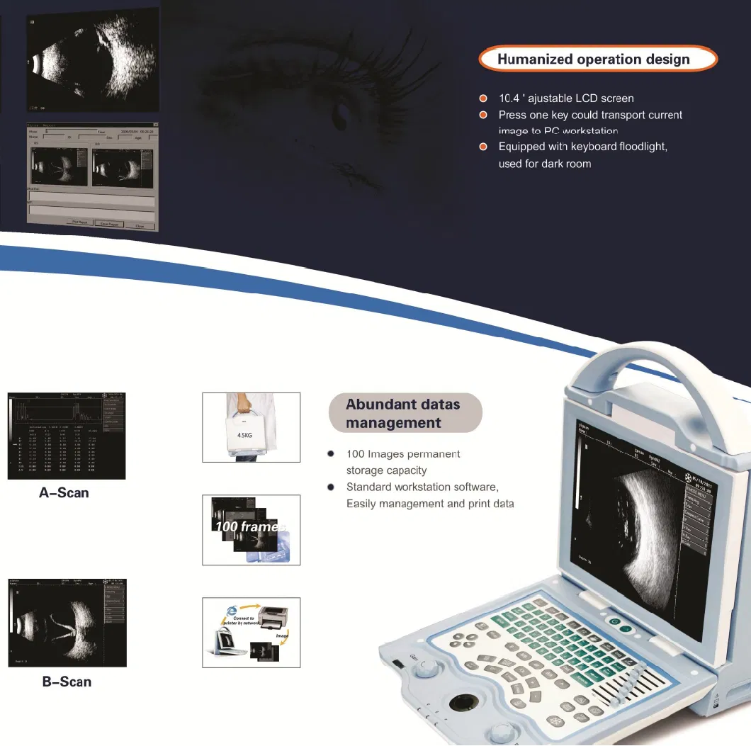 China Full Digital Ophthalmic a/B Ophthalmic Optical Ultrasound Scanner