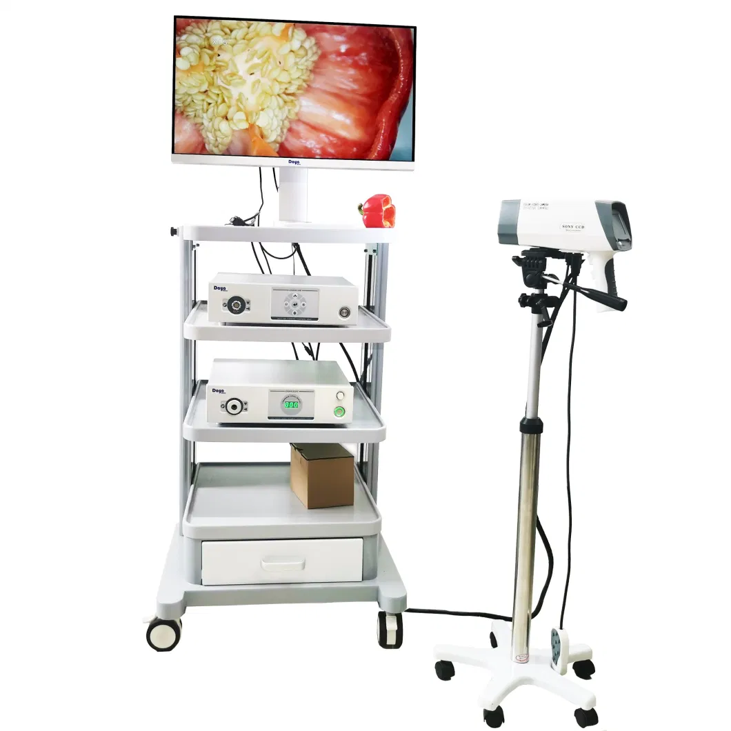 Digital Hospital Use Laptop Colposcope