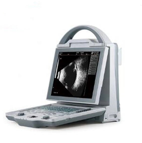 China Full Digital Ophthalmic a/B Ophthalmic Optical Ultrasound Scanner