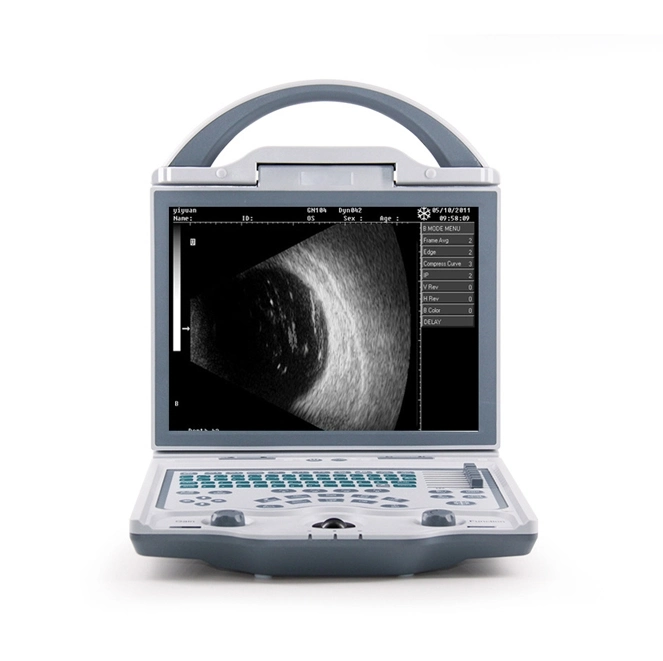 China Full Digital Ophthalmic a/B Ophthalmic Optical Ultrasound Scanner