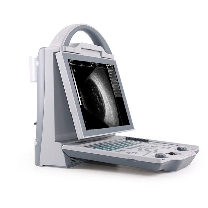 China Full Digital Ophthalmic a/B Ophthalmic Optical Ultrasound Scanner