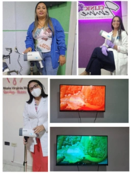 Hospital Use Medical Video Colposcope Digital for Cervix Vagina Examination